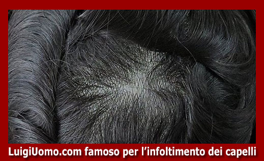 12-parrucche-parrucchino-toupee-toupet-per-uomo-e-donna-a-Genova,