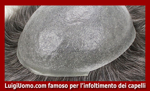 13-parrucche-parrucchino-toupee-toupet-per-uomo-e-donna-a-Genova,