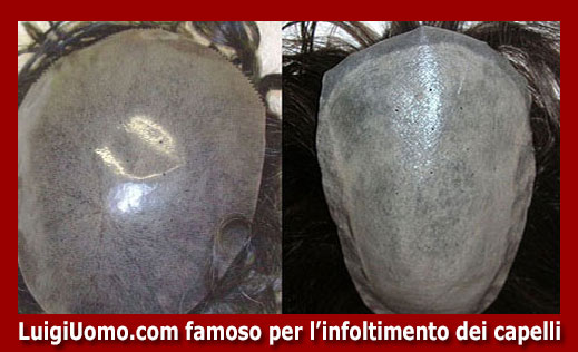 16-parrucche-parrucchino-toupee-toupet-per-uomo-e-donna-a-Genova,