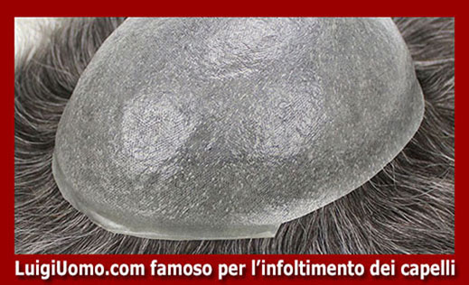 Patch-cutanea-Venafro-4