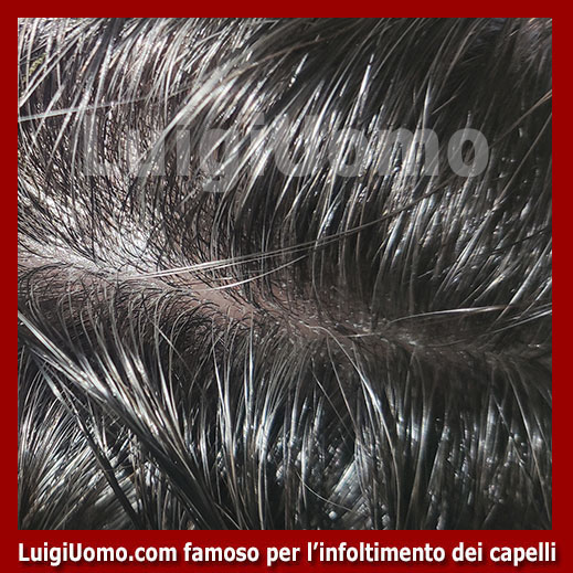 Patch-cutanea-Venafro-3