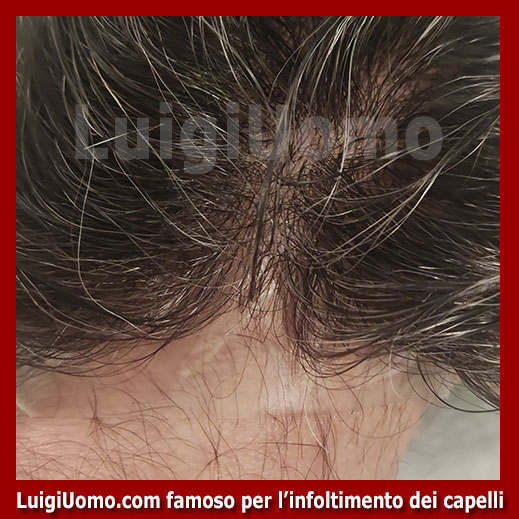 Patch-cutanea-Venafro-1