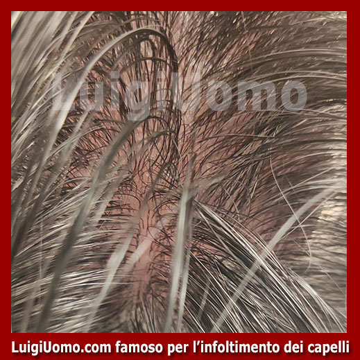 Patch-cutanea-Venafro-2