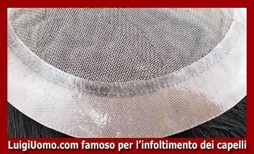 5-protesi-capelli-lace-a-Reggio Emilia-per-uomo-donna-infoltimento-capelli-impianti-capillari-patch-cutanea-membrana-capillare-
