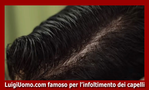 protesi di capelli Trieste - modello 6 - protesi-di-capelli-Trieste