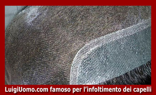 protesi di capelli Trieste - modello 4 - protesi-di-capelli-Trieste