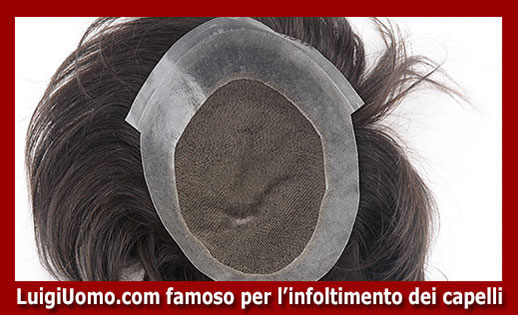 protesi di capelli Trieste - modello 5 - protesi-di-capelli-Trieste