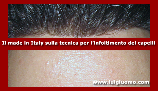 Toupee Toupet Parrucchino per uomo donna lazio per uomo donna Frosinone Latina Rieti Roma Viterbo di modello 11