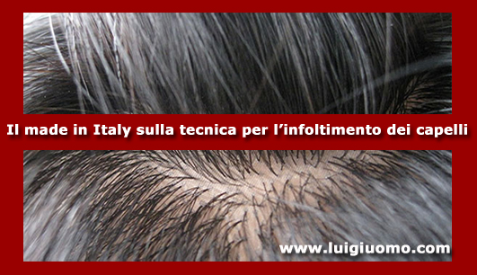 Toupee Toupet Parrucchino per uomo donna lazio per uomo donna Frosinone Latina Rieti Roma Viterbo di modello 2